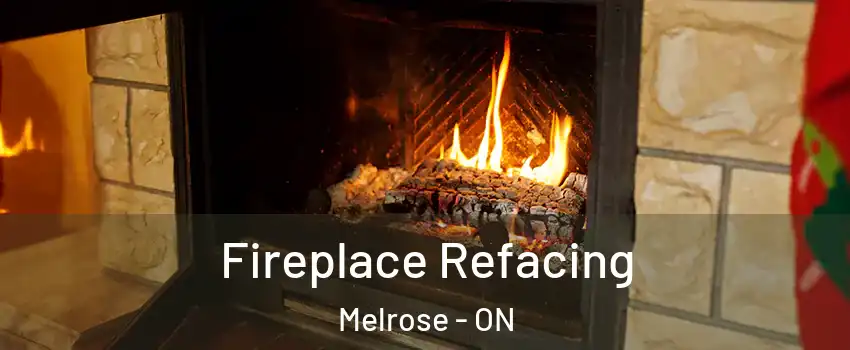  Fireplace Refacing Melrose - ON